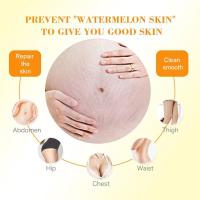 Crema reparadora de estrías Pasjel de Tailandia, 50ml, marcas potentes, cicatriz postparto, estiramiento Cr, removedor precioso para el cuerpo durante el embarazo Sk U0T0 - details 6