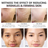 Retinol crema blanqueadora facial suero para ojos esencia facial antiarrugas reafirmante Lifting mejora las líneas brillo hidratación fina - details 20