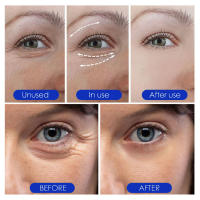 Microaguja azul que reduce los poros, blanqueamiento en esencia Facial, suero de línea fina firme, hidrata la melanina, elimina el producto para el cuidado de la piel - details 7
