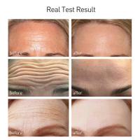 Suero de pulpa cruda de arroz, esencia para la cara con ácido hialurónico, nutritivo, hidratante, blanqueador, antiarrugas, ilumina el cuidado de la piel Facial suave - details 3