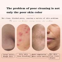 Eliminador de espinillas al vacío, herramienta de limpieza Facial para el acné, equipo de belleza para uso doméstico, venta al por mayor - details 7