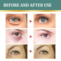 Crema para los Ojos EELHOE Ilumina Ojeras, Adiós a las Bolsas, Reafirma y Hidrata - details 7