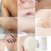 Jabón blanqueador corporal, jabón blanqueador para axilas y rodillas, eliminación de piel de pollo, eliminación de manchas oscuras, piel muerta, hidrata, ilumina el cuidado del cuerpo - details 2