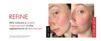 Crema para eliminar arrugas, Retinol, cara, antienvejecimiento, reafirmante, levantamiento, desvanecimiento, líneas finas, mejora la sequedad de la piel, hidratante, ilumina el cuidado de la piel - details 5