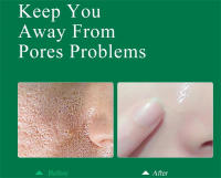 Crema de reducción de poros con ácido salicílico, Reduce los poros grandes, aprieta la refinación, repara los poros ásperos y opacos, ilumina el cuidado de la piel - details 4