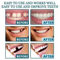 Eelhoe, 1 par, dentaduras postizas ajustables para blanquear los dientes, sonrisa perfecta temporal, cuidado de la higiene bucal, carillas dentales, juego de dientes falsos - details 8