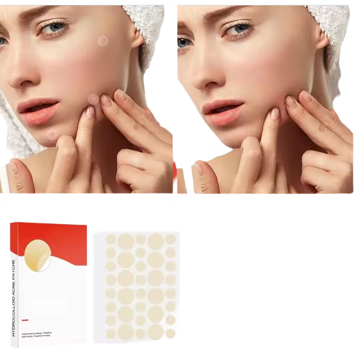 Parches Para Acné Y Marcas De Puntos De Cuidado Facial 144pcs Invisibles Tratamiento De Acné Y Cicatrices De Puntos Para Belleza - 1