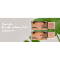 SOME BY MI V10 Hyal Air Fit SPF 50 1.69oz, 50ml Centella Protector solar facial con protección UV No graso, fundición blanca, sin ojos - details 7