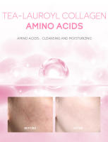 Limpiador Facial Suave de Sakura Control de Aceite Profundo de Poros Reducción de Pontos Negros Hidratación Herramientas de Cuidado de la Piel de Belleza - details 8