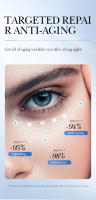 SADOER Caviar ácido hialurónico crema para ojos Anti ojeras eliminación ojos bolsas reafirmante hidratante belleza ojos productos para el cuidado de la piel - details 5