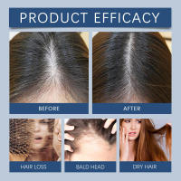 Spray repara la esencia seca, rizada, brillante, suave, nutritiva e hidratante para el cuidado del cuero cabelludo y el cabello. - details 7