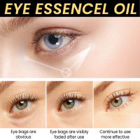 Esencia para aclarar las líneas finas, humectante reafirmante, elimina las arrugas de la piel, elimina las bolsas de los ojos, alivia las ojeras, tratamiento de hinchazón - details 5