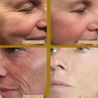 Eliminación instantánea de arrugas, bálsamo de rebote múltiple, crema Facial antienvejecimiento, crema hidratante coreana antiarrugas, productos para el cuidado de la piel - details 6