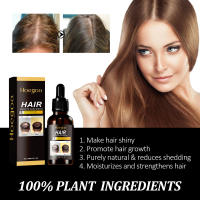 La esencia de jengibre mejora el aceite esencial para el cuidado del cabello seco, peludo, hidratante, suave, esponjoso y brillante - details 5