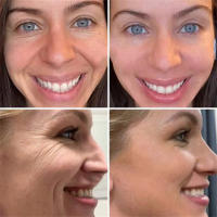 Retinol eliminador de arrugas, conjunto facial, reafirmante instantáneo, suero antienvejecimiento, desvanecimiento de líneas finas, blanqueamiento, productos coreanos para el cuidado de la piel - details 6