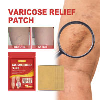 Parche para alivio de venas, parche para varices, bulto de venas, lombriz de tierra, reparación de piernas, parche para el dolor de hinchazón de piernas - details 1