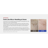 microneedle, Zero exosome shot, Lacto exosome, instant pore-tightening care, Pore Refining serum