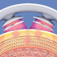 Nuevo masajeador inteligente de músculos de hombros y cuello, relajación eléctrica por calor, cuerpo en cualquier momento, carga USB, blanco - details 6