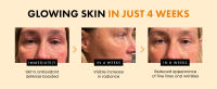 vita c dark spot serum vitamin c serum with hyaluronic acid face brightening eclat skincare