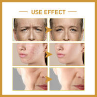 Suero de pulpa cruda de arroz, esencia para la cara con ácido hialurónico, nutritivo, hidratante, blanqueador, antiarrugas, ilumina el cuidado de la piel Facial suave - details 8