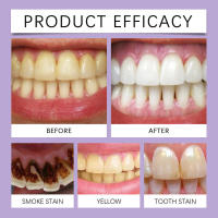 El cepillo de dientes morado proporciona una limpieza suave para los dientes, protege las encías y refresca el aliento. - details 8