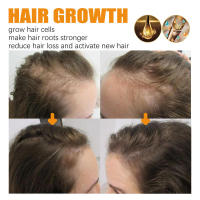La biotina hidrata profundamente y mejora el cuidado del cuero cabelludo, suaviza el aceite esencial para el cuidado del cabello. - details 8