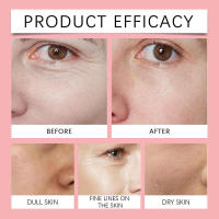 La crema para la piel con retinol es una crema facial suave, hidratante, tierna, humectante, delicada, brillante y bien cuidada. - details 8