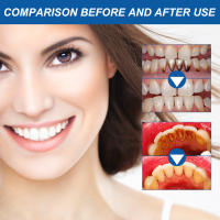 Pluma de Líquido de Reparación de Chicle Elimina Manchas Dentales, Blanquea Dientes, Cuida Encías, Cuidado Oral, Belleza - details 9