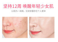 Herramienta de Cuidado de la Piel Facial de Microcorriente Ems Caliente y Fría - details 10