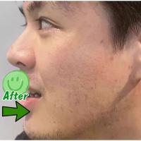 Suero corrector de manchas oscuras, crema blanqueadora hidratante para la piel Facial, Reduce las pecas, la opacidad, el acné y la melanina - details 15