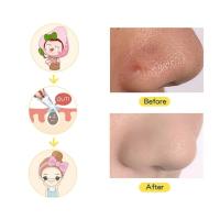 Removedor eléctrico de espinillas al vacío, limpieza de poros, puntos negros faciales, puntos blancos, espinillas, limpiador de acné, herramienta de cuidado Facial, Belleza - details 2