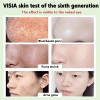 Té verde Original, elimina profundamente los puntos negros, mascarilla de barro para acné, palo, reduce los poros, disipa la crema para el acné, trata las espinillas, cuidado coreano de la piel limpia - details 5