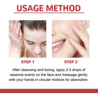 Sérum Facial Coreano Niacinamida Ilumina la Piel, Rejuvenece, Hidrata, Blanquea, Desvanece Manchas y Líneas Finas Herramienta de Cuidado de la Piel de Belleza - details 1