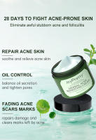 Crema Facial a base de hierbas para el acné, eliminación de marcas de espinillas, Control de aceite, crema hidratante para el rostro, cremas faciales suaves, productos para el cuidado de la piel JoyPretty - details 2