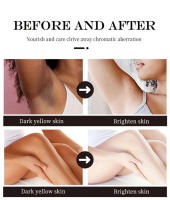 Crema blanqueadora de 50g para partes privadas, blanqueamiento de axilas, blanqueamiento de glúteos y rodillas, ilumina la parte interna del muslo, partes íntimas, elimina la melanina oscura - details 5