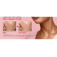 ANUA Niacinamida Suero 10 + TXA 4 Ácido Hidrotonico, Tranexámico, Vitamina B12 - details 11