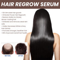 Essence Nutrition Root Nourishing Care Aceite esencial para fortalecer el cabello - details 5