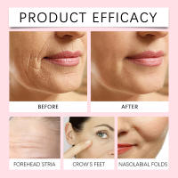 Retinol hidratante, nutritivo, iluminador de la piel facial, esencia delicada e hidratante - details 8