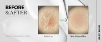 VT COSMETICS CICA Reedle Shot 100, suero con microagujas Spicule para el cuidado y exfoliación de los poros, exosoma, Centella Asiatica para vidrio - details 5