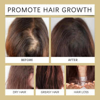 Acondicionador de romero, nutre, hidrata, mejora la sequedad del cabello, refresca y controla la grasa del cabello. - details 7