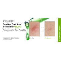 Anua Azelaic Acid 10 Hyaluron Redness Soothing Serum, Suero facial para pieles sensibles, Ácido hialurónico, Niacinamida, Cuidado de manchas, - details 4