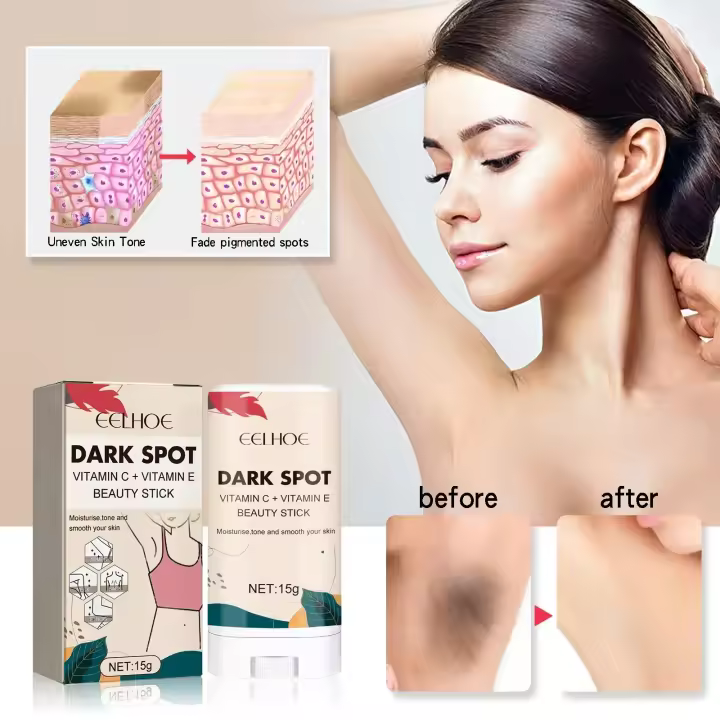 Crema blanqueadora para blanquear el cuerpo, Reduce las manchas negras, reparación hidratante, eliminación de articulaciones del codo, partes íntimas, manchas oscuras, blanqueador de melanina - 1