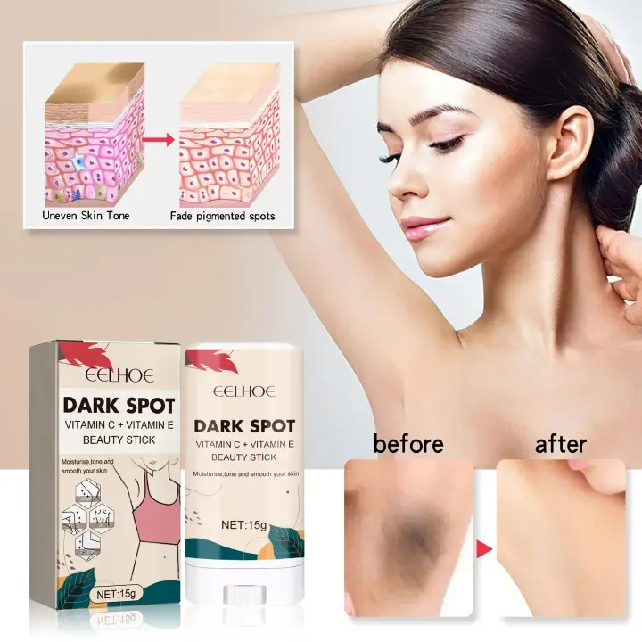 Crema blanqueadora para blanquear el cuerpo, Reduce las manchas negras, reparación hidratante, eliminación de articulaciones del codo, partes íntimas, manchas oscuras, blanqueador de melanina - 1