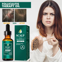Limpia profundamente, repara las raíces del cuero cabelludo, alivia la picazón, previene la caída y solidifica el aceite esencial para el cuidado del cabello. - details 0