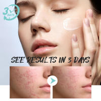 Crema de día correctora antienrojecimiento Facial, crema para el cuidado de la piel sensible a la picazón, crema hidratante para iluminar la Base, cosméticos - details 9