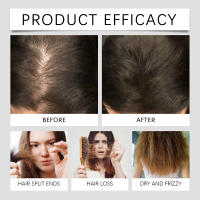 Mejora la calidad del cabello, hidrata, suaviza, brilla el cabello y nutre el aceite esencial para el cuidado del cuero cabelludo - details 9