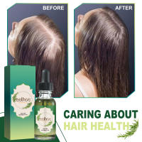 El romero nutre suavemente el cuero cabelludo, espesa, nutre, fortalece y solidifica el aceite esencial para el cuidado del cabello - details 8