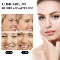 Mascarilla Facial de Colágeno Bio Reafirmación de Líneas Finas Levantamiento Antigüedad - details 6