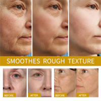 Retinol eliminador de arrugas, conjunto facial, reafirmante instantáneo, suero antienvejecimiento, desvanecimiento de líneas finas, blanqueamiento, productos coreanos para el cuidado de la piel - details 0