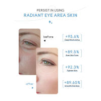 LAIKOU Crema Hidratante e Iluminadora para el Contorno de Ojos 20g - details 5